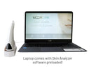 Skin Analyzer Camera & Software Only